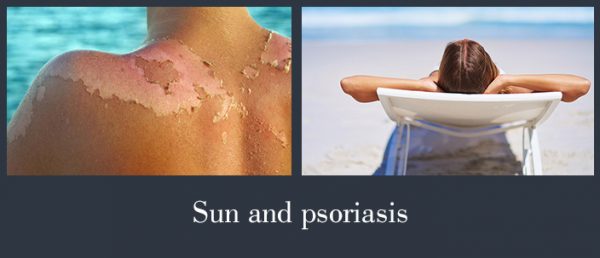 sun and psoriasis