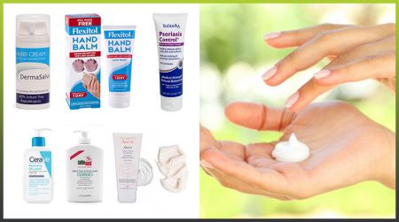 Hand creams for psoriasis